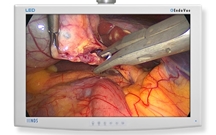 NDS Surgical Imaging EndoVue HD LED 24" Widescreen Monitor 